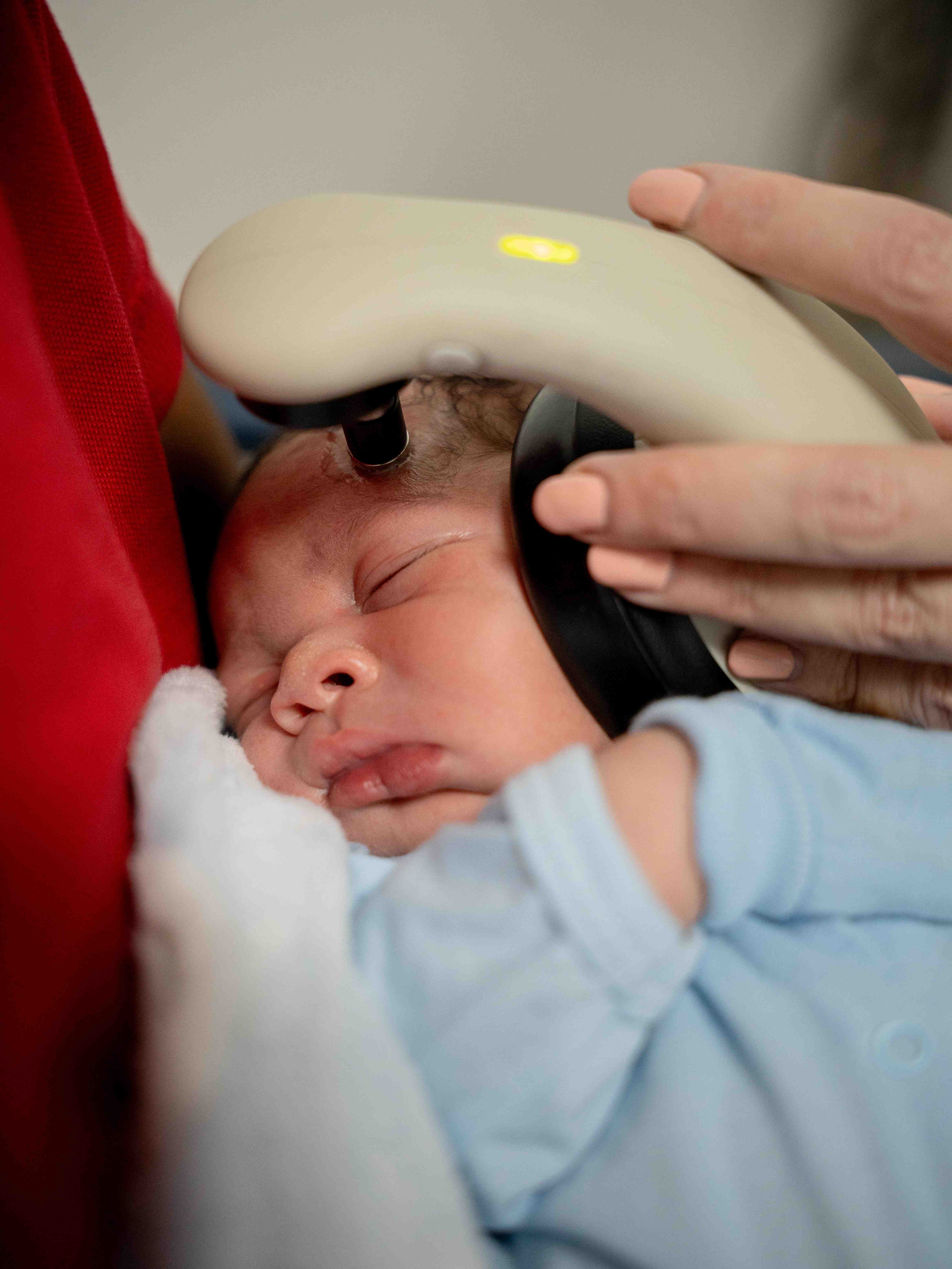 Early Detection of Neonatal Hearing Loss